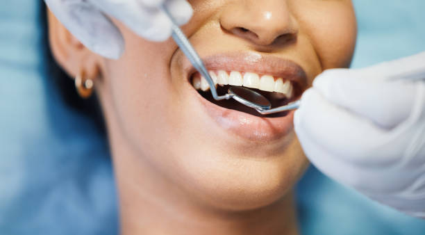 Best Emergency Treatment for Dental Infections or Abscesses in Media, PA