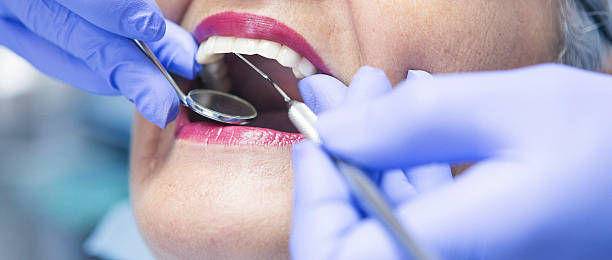 Best Urgent Care for Lost Fillings or Crowns in Media, PA